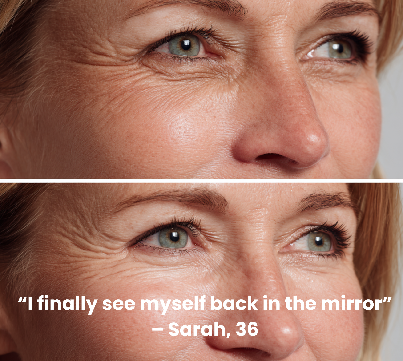 Duovera Wrinkle Patch Eyes